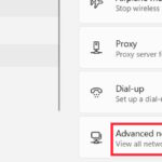 cách cấu hình adapter settings