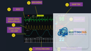 cách theo dõi monitor settings