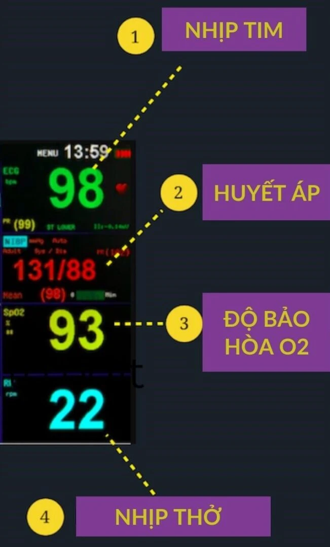 cách theo dõi monitor settings - Hình 5